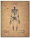 BigWig Prints - Doctor and Nurse Patent Wall Art, Vintage Medical Posters Featuring Classic Medical Inventions, Perfect for Clinics, Hospitals, or Offices - Unframed Set of 6 (8x10)