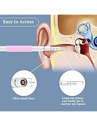 Oreja Endoscopio WiFi, USB Oreja Otoscopio Cámara de inspección Portátil Inalámbrico HD...