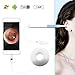 USB Ear Otoscope, Earwax Cleaning Endoscope 1.3 Megapixels HD 720P Ear Inspection Camera with Ear Wax Removal Tools Kits for Android Windows Made by ACELIST