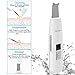 RICANK Facial Skin Scrubber Blackhead Remover Pores Cleanser Cutin Comedones Removal Skin Peeling Pimple Extractor Blemish Exfoliation Skin Exfoliator White