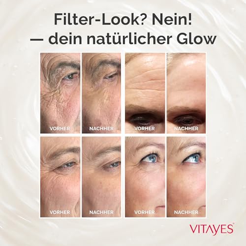 Vitayes, Instant Ageback, Lifting Cream (15ml) - Smooth Skin in Just 5 Minutes An innovative solution from Germany against wrinkles, saggy skin and tear bags.