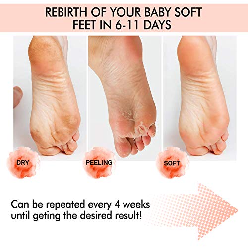 Foot Peel Mask- Deeply Exfoliates and Peels Away the Dead Skin, Cracks & Calluses,repairs rough heels revealing baby soft feet-Pack of 2 Pairs of Plastic Foot Mask for Men and Women (Lavender)