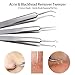 Herwiss Blackhead Remover Tools, Acne Removal Kit With Comedones Extractor, Zit Popper, Curved Tweezer Clip for Risk Free Nose Face Skin Care, Treatment for Blemish, Whitehead Popping, Zit Removing