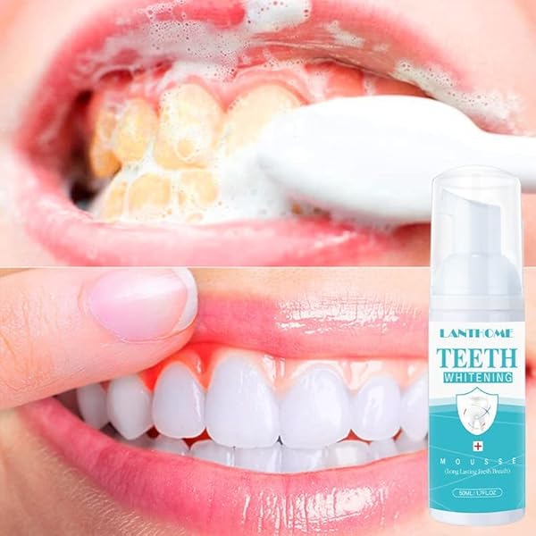 LANTHOME WHITE FOAM TEETH WHITENING PRODUCTS-TOOTH WHITENING MOUSSE, EASY TO USE TEETH WHITENER FOAM FOR WHITE TEETH,FRESHENS BREATH, WHITENS TEETH & FIGHTS BAD BREATH 50ML