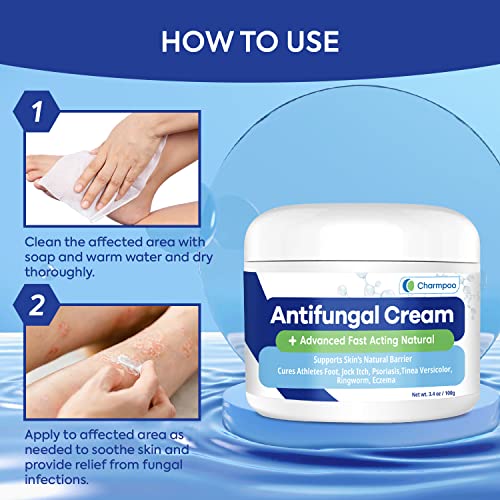 Antifungal Ringworm Cream Treats Stubborn Ringworm Antifungal Cream