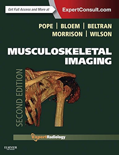 Download Musculoskeletal Imaging E-Book (Expert Radiology) (English Edition) PDF