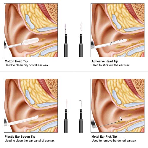 Aisheny 3-in-1 Digital Led Otoscope, Protable Ear Camera Scope Earwax Removal Kit Ear Wax Cleaning Tool Waterproof Rated IP67, USB Micro USB Type-C