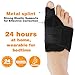 Forsisco Bunion Corrector Orthopedic Bandages for anatomical joints Bunion Splint Big Toe Separator Pain Relief Non-Surgical Hallux Hammer for men and women