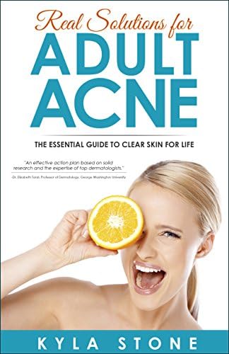 Real Solutions for Adult Acne: The Essential Guide to Clear Skin for Life