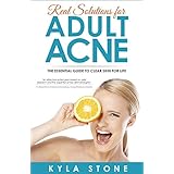 Real Solutions for Adult Acne: The Essential Guide to Clear Skin for Life