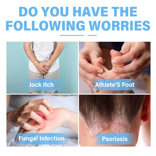 Skin Fungus Cream, Intensive Treatment for Athlete's Foot, Eczema, Groin Fungus & Tinea Versicolor, Suitable for Face and Body Care, Non-Irritating, 60 ml