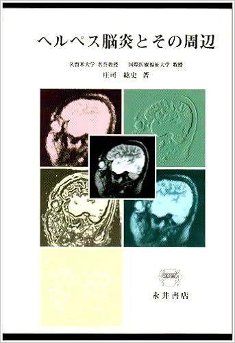 ダウンロード ヘルペス脳炎とその周辺 Pdf Epub Mobi Ebook Onlinebooksjapan Live