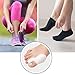 Accmor 2 Pairs of Bunion Corrector and Bunion Relief kit. Toe Separators, Toe Straightener, Bunion Splint,Bunion Protector, Adjustable, One Size Fit All