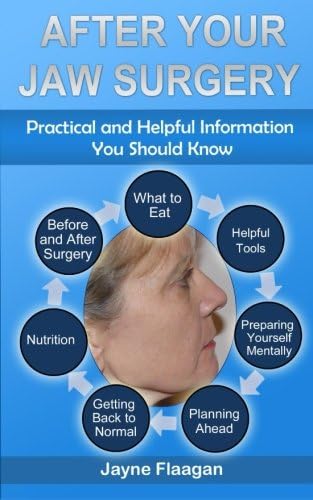 After Your Jaw Surgery: Practical and Helpful Information You Should Know Paperback – February 14, 2014