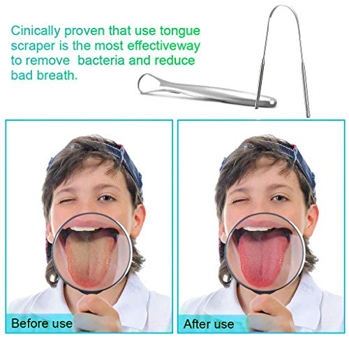 Tongue Scraper Cleaner for Adults Kids, BUVE Set of 4 Stainless Steel and Plastic Tongue Brush Oral Care Kit for Fresh Breath with Travel Carrying Case