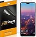 Supershieldz (6 Pack) Designed for Huawei P20 Screen Protector, High Definition Clear Shield (PET)