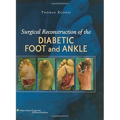 Surgical Reconstruction Of The Diabetic Foot And Ankle Surgical Reconstruction Of The Diabetic Foot And Ankle