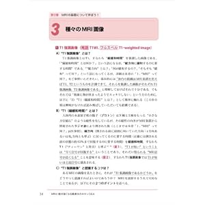 Emuaruai ni zettai tsuyoku naru satsuzoho no kihon kyu ando e : Satsuzoho no tekio ya miwakekata nado higoro no gimon ni kotaemasu.