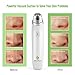 Electric Blackhead Remover Facial Pore Cleaner, Powerful Pore Vacuum Acne Suction Exfoliating Tool
