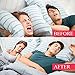 2-in-1 Snoring Solution,Stop Snoring Anti Snoring Devices Nose Vents Plugs Nose Dilator Snoring Sleep Aid for Men and Women with Air Purifier Filter