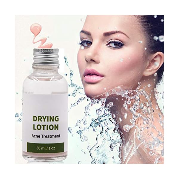 acne spot treatment serum