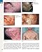 Andrews' Diseases of the Skin: Clinical Dermatology