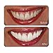 Go Smile GS134 Super White Teeth Whitening System Snap Pack Kit (14) with Microfiber Cloth