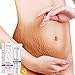 Enjoyment Scars Removal Cream Stretch Marks Cream Pregnancy Skin Care Belly Butter - Plant Nutrition Repair Ingredients to Help Prevent & Reduce Stretch Marks, 40G/1.4oz