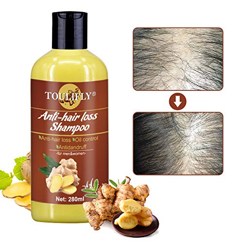 Ginger Shampoo,Anti Hair Loss Shampoo,Hair Growth Shampoo,Hair Regrowth