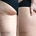 Crema De El Cafe Verde Para Eliminar La Celulitis - Crema Adelgazante Anticelulitis - Hidrata La Piel - Tratamiento 16 Onzas