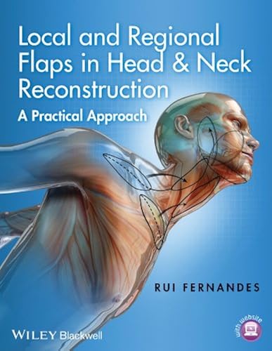 Download Local and Regional Flaps in Head and Neck Reconstruction: A Practical Approach PDF
