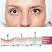 Hyaluron Injection Pen, Restore Skin Elasticity, Deep Replenishment And Rich Nourishment, Helps to Reduce Blemishes, Wrinkles and Marks (with 2 Ampoules)