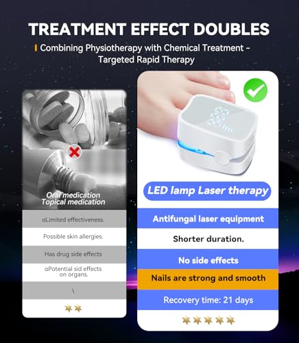 Next-Gen Nail Fungus Laser Device【21-day Fast-acting】Antifungal Laser【Kaltlicht-Technologie - Wohltuend mild】 PainFree Device With Time Display & Yellow Cuticle Oil Pen