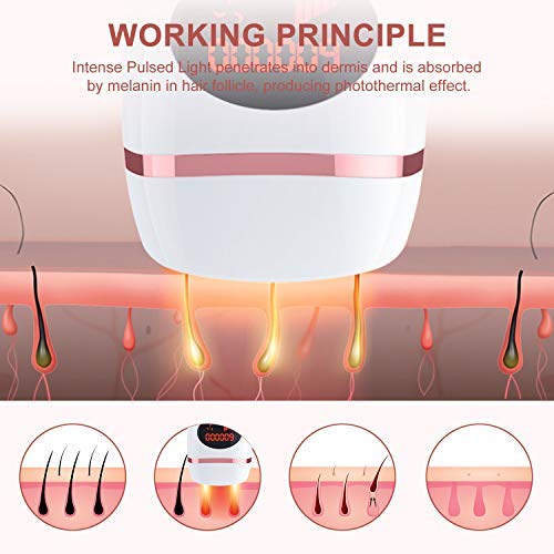IPL Hair Removal Device, Permanent Hair Removal System for Women and Men Professional Painless Use for Home 600,000 Flashes (white rose-2) - Thumbnail 2