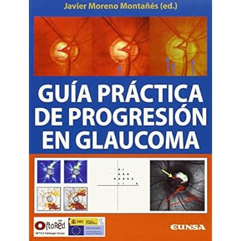 Guía práctica de progresión en glaucoma (Libros de medicina) Guía práctica de progresión en glaucoma (Libros de medicina)