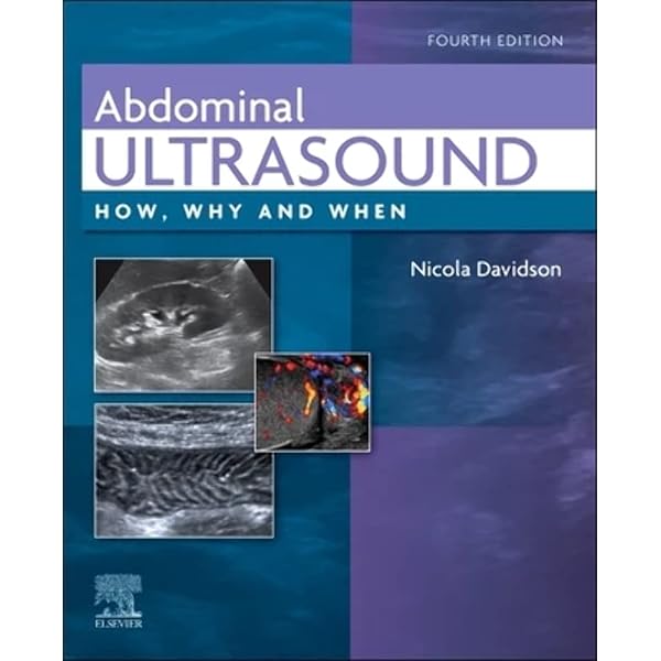 Breast Ultrasound: How, Why and When: 9780443100765