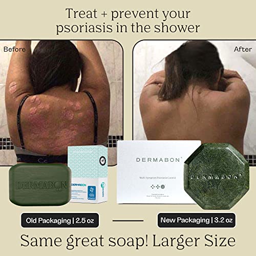 DERMABON 2 Coal Tar Psoriasis Body Wash & Eczema Bar Soap Control