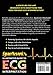 Sparkson's Illustrated Guide to ECG Interpretation