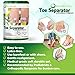 Bunion Corrector - Orthopedic Bunion Corrector for Big Toe - Toe Separators Help Provide Bunion Relief - Straightens Toes - Soft Medical Grade Gel - Comfortably Worn with Or Without Shoes