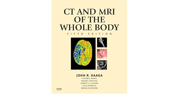 Computed Tomography Magnetic Resonance Imaging Of The - 