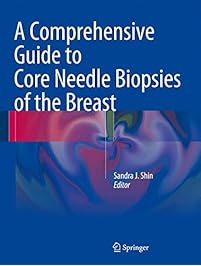 A Comprehensive Guide to Core Needle Biopsies of the Breast