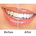 Grinigh Coconut Oil Whitestrips Professional Effects Teeth Whitening Strips Kit, 14 Treatments - Lasts 6 Months & Beyond - Non-Slip White Strips with a Fresh Coconut Fragrance