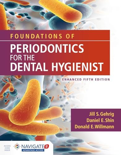 Essentials of Dental Caries: 9780198738268: Medicine & Health