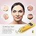 Acne Scar Removal Cream Skin Repair Face Cream For Burns Cuts Operation Stretch Mark Remover Acne Scar Treatment