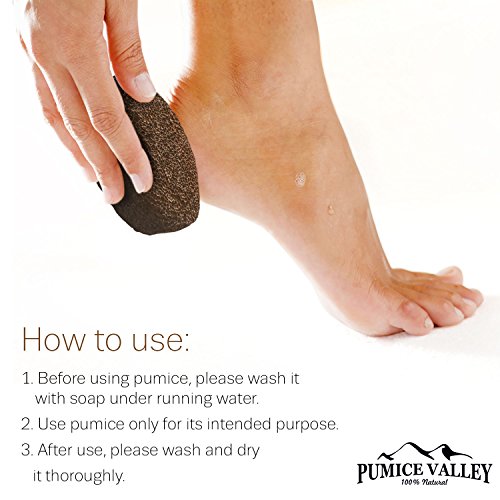 Pumice Stone for Feet - Natural Lava Foot Stone with New Eco-Friendly Holder - Callus Warts Corn Removal - Pedicure Exfoliator for Dry Dead Skin, Heels, Elbows, Hands - Healthy Foot Care Scrubber - Thumbnail 5