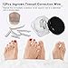Anself 12Pcs Ingrown Toenail Correction Wire Fixer Toe Nail Corrector Pedicure Treatment Foot Care Tool