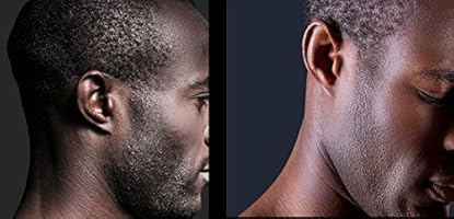 2 Pieces Of Exfoliating Head Body Armpit And Facial Ingrown