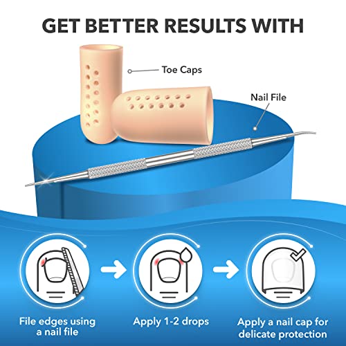 Professional Ingrown Toenail Treatment Kit (4Pcs) 50 More Efficient