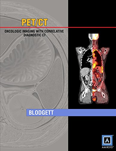 Specialty Imaging PET/CT: Oncologic Imaging with Correlative Diagnostic ...