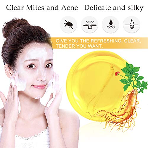 Acne Soap, Handmade Soap, Essential Oil Soap, Face Cleaner Antimite